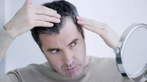 Saç ekiminde merak edilenler